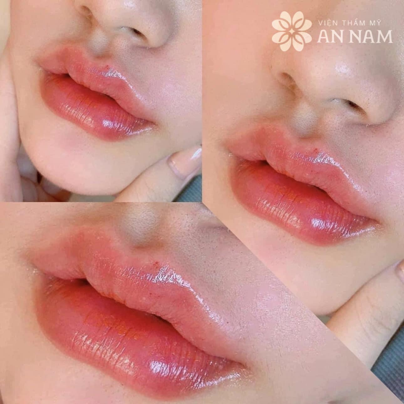 Phun xăm thẩm mỹ