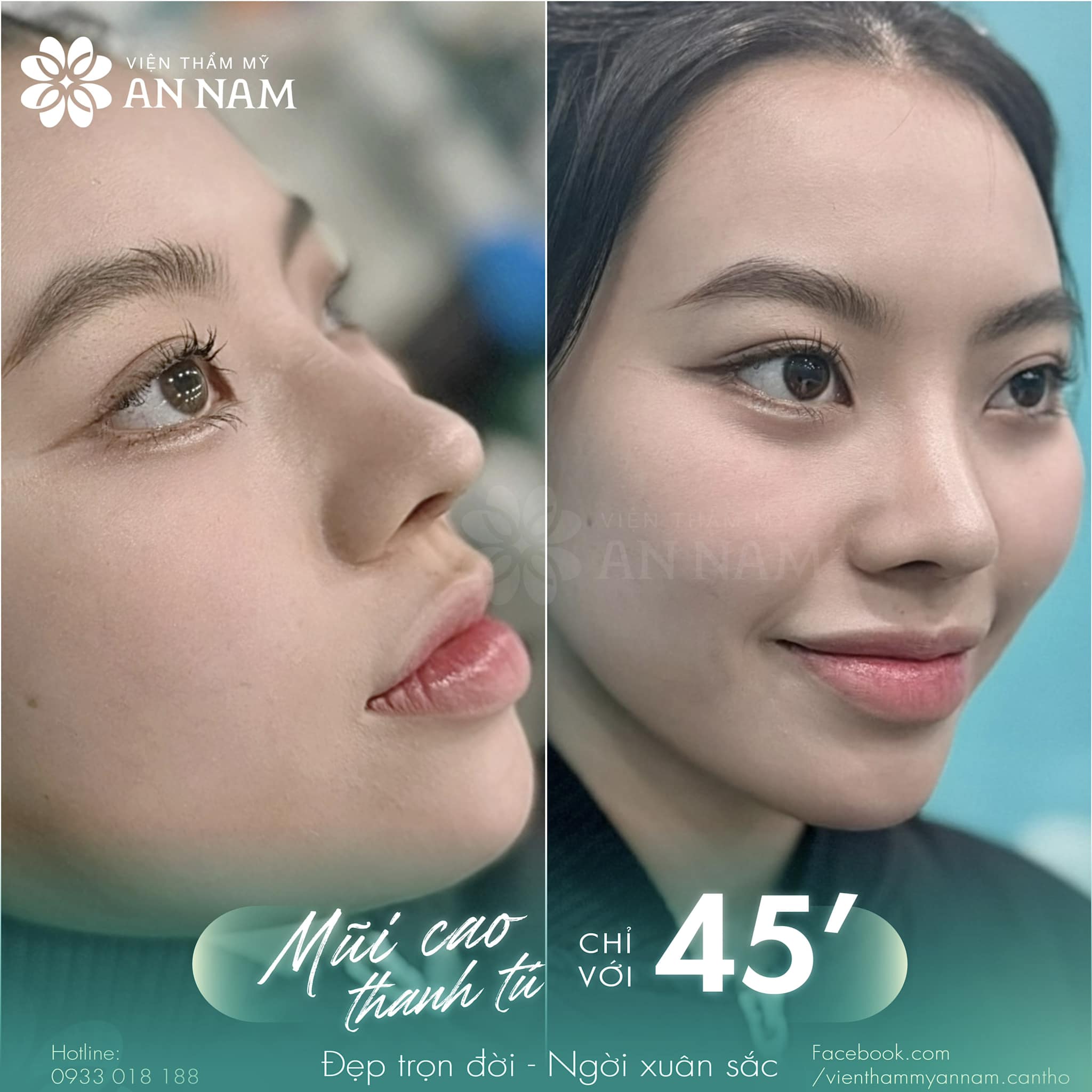 Phẫu thuật thẩm mỹ